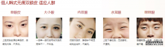 西安俪人整形医院双眼皮手术多少钱？效果？