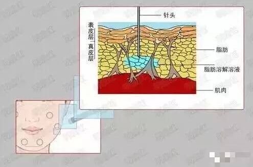 减脂原理