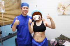 韩国吸脂塑形案例 韩国吸脂塑形案例