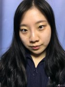 眼睛、鼻子修复术后4周案例 眼睛、鼻子修复术后4周案例