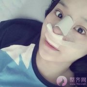 隆鼻修复手术改变了我的一生! 隆鼻修复手术改变了我的一生!