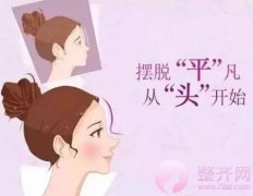 自体脂肪填充额头,有额头才是真美女 自体脂肪填充额头,有额头才是真美女