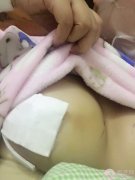成都驻颜自体脂肪隆胸案例 成都驻颜自体脂肪隆胸案例