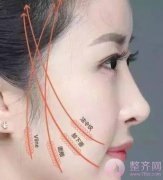 大v线拉皮与蛋白细线埋线紧实有什么区别? 大v线拉皮与蛋白细线埋线紧实有什么区别?