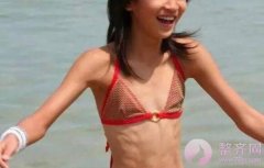 自体脂肪隆胸的基础知识 自体脂肪隆胸的基础知识