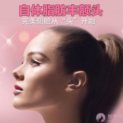 丰额头,助你丰出好运气 丰额头,助你丰出好运气