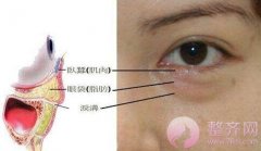眼袋抽脂效果好吗? 眼袋抽脂效果好吗?