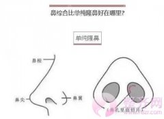 你是适合做隆鼻还是? 你是适合做隆鼻还是?