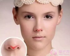 为什么做完鼻子还是不满意? 为什么做完鼻子还是不满意?