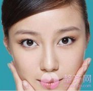 两眼间距过宽,有什么办法改善? 两眼间距过宽,有什么办法改善?