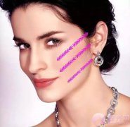 蛋白线 | 用1厘米的提升,换10年的青春! 蛋白线 | 用1厘米的提升,换10年的青春!