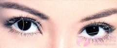 埋线双眼皮真的是“自然”的选择吗? 埋线双眼皮真的是“自然”的选择吗?