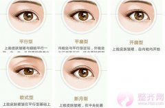 眼部手术后需要注意哪些问题。 眼部手术后需要注意哪些问题。