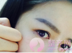 双眼皮成本那么低,凭什么收费那么贵? 双眼皮成本那么低,凭什么收费那么贵?