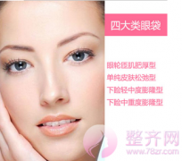 韩式去眼袋 恢复炯炯有神美眸 韩式去眼袋 恢复炯炯有神美眸