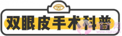 做完双眼皮后的五个重要阶段 做完双眼皮后的五个重要阶段