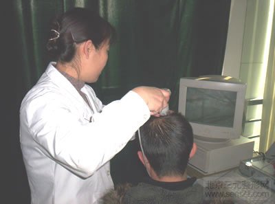 FUE微创植发术 毛囊检测