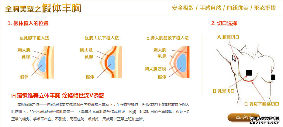 隆胸示意图
