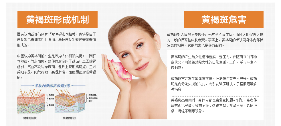 产后黄褐斑去除