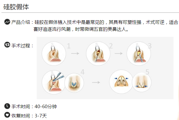 上海天大整形医院陈达硅胶假体隆鼻 上海天大整形医院陈达硅胶假体隆鼻