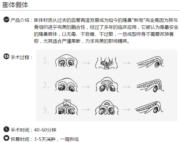 上海天大整形医院陈达膨体隆鼻 上海天大整形医院陈达膨体隆鼻