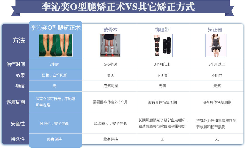 北京李沁奕矫正o型腿