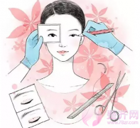 割双眼皮高不高？术后护理很重要!