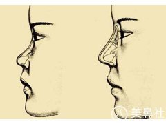 北京八大处刘暾介绍