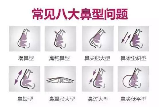 娇俏的鼻子,高颜值的标配!