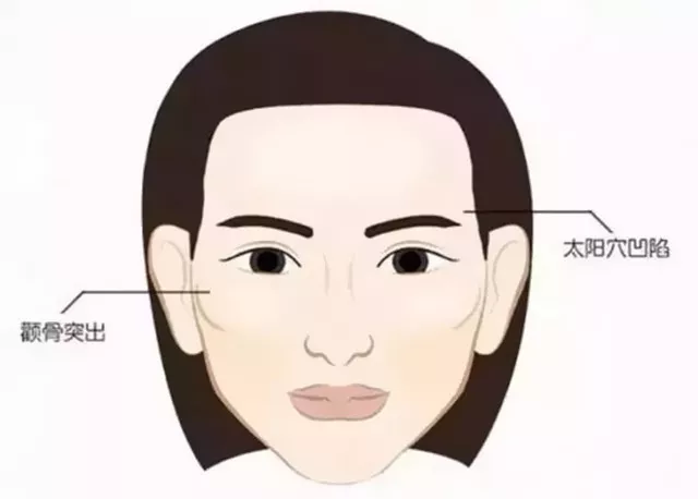 自体脂肪填充能让脸瘦起来!
