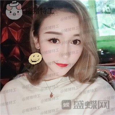 贵阳华美,黄在弘,面部填充,案例,价格,