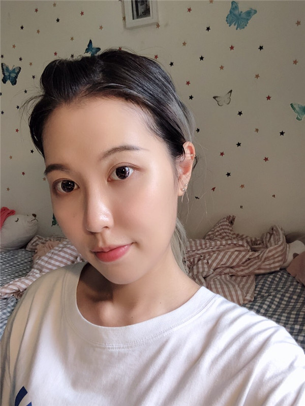 昆明梦想整形李成龙眼部整形怎么样?价格案例