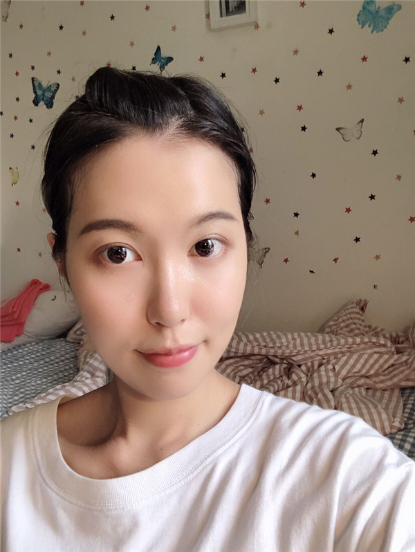 昆明梦想整形李成龙眼部整形怎么样?价格案例