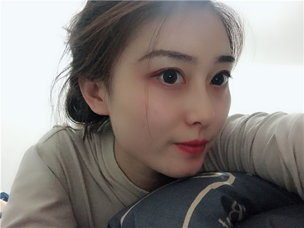 杭州瑞丽何涛鼻部修复怎么样?价格案例