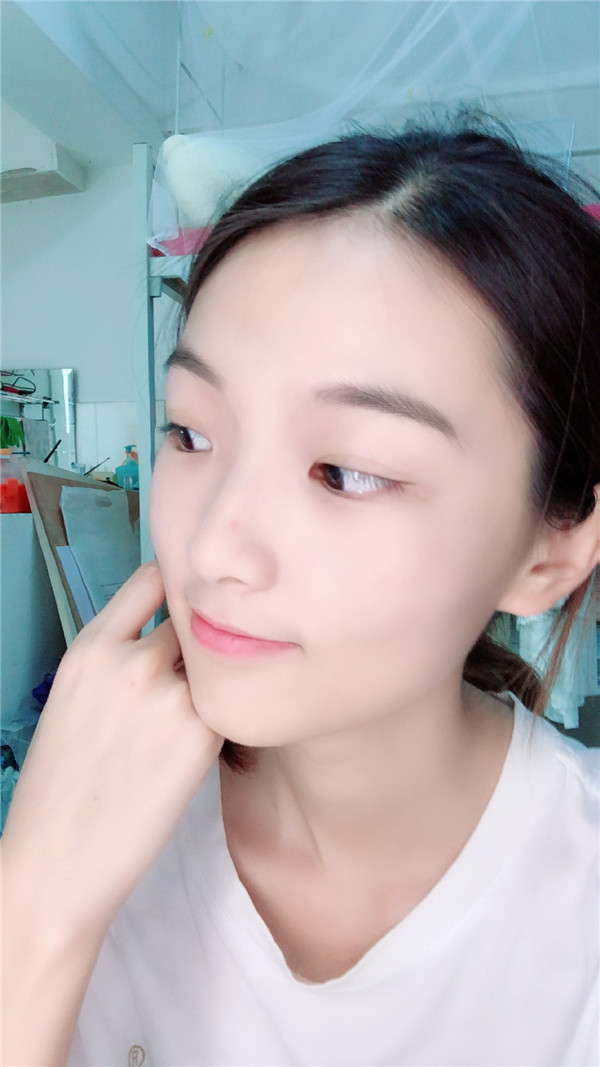 重庆时光李理鼻部手术怎么样?价格案例