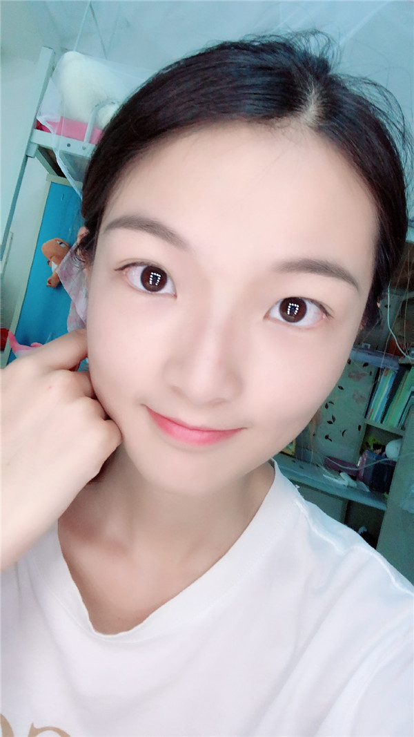 重庆时光李理鼻部手术怎么样?价格案例