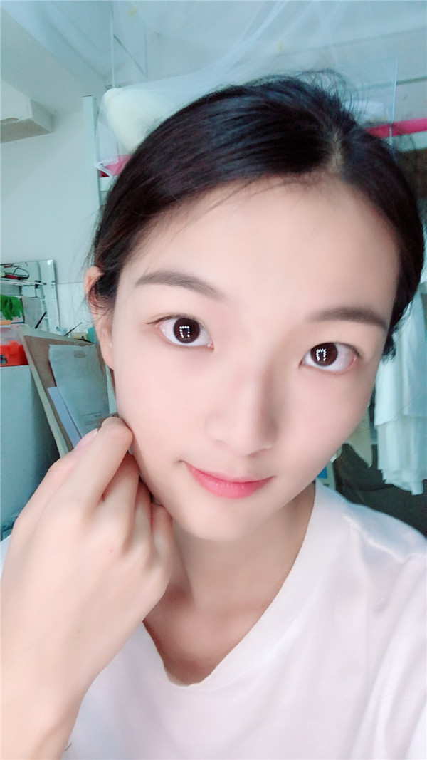 重庆时光李理鼻部手术怎么样?价格案例