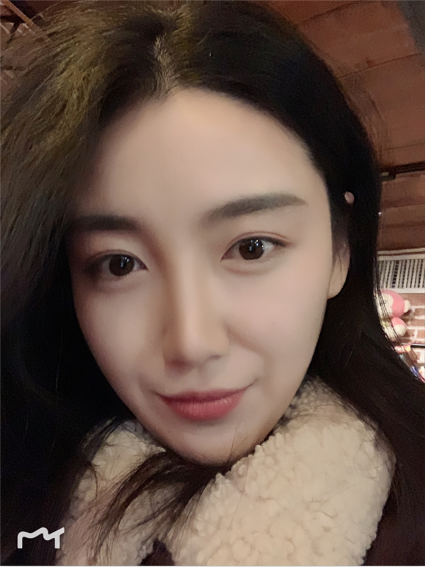深圳鹏爱秀琪谭涛脂肪填充怎么样?价格案例