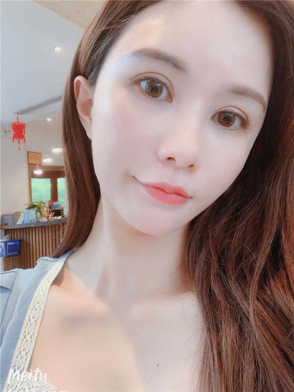 杭州维多利亚脂肪填充怎么样?价格案例