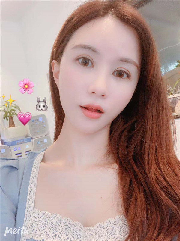 杭州维多利亚脂肪填充怎么样?价格案例