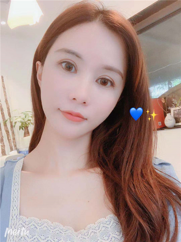 杭州维多利亚脂肪填充怎么样?价格案例