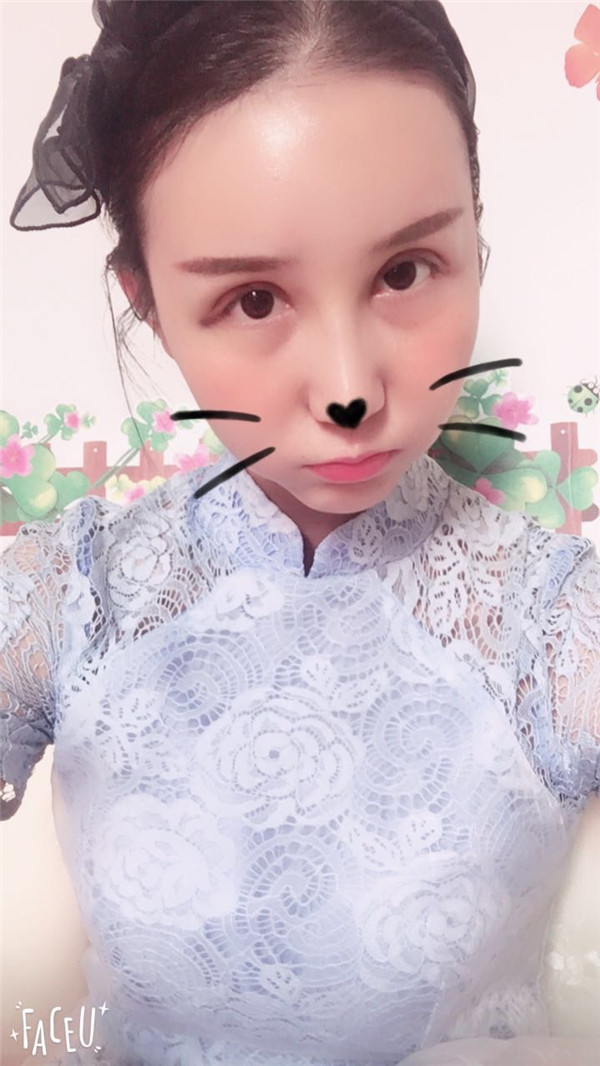 苏州紫馨眼部综合怎么样?价格案例