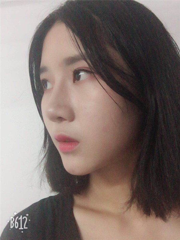 武汉美基元汪福强垫下巴怎么样?价格案例