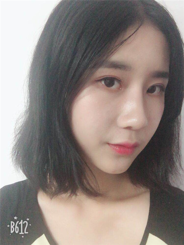 武汉美基元汪福强垫下巴怎么样?价格案例