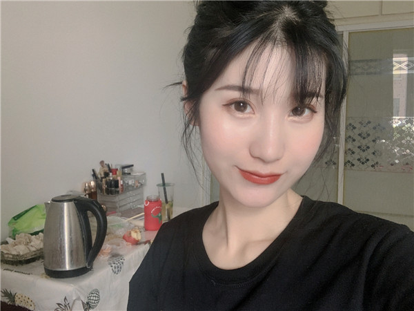 珠海科美张民望脂肪丰太阳穴怎么样?价格案例