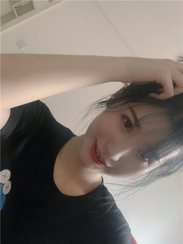 珠海科美张民望脂肪丰太阳穴怎么样?价格案例