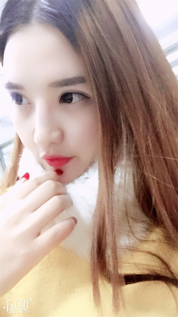 哈尔滨韩美整形于兆松脂肪填充怎么样?价格案例