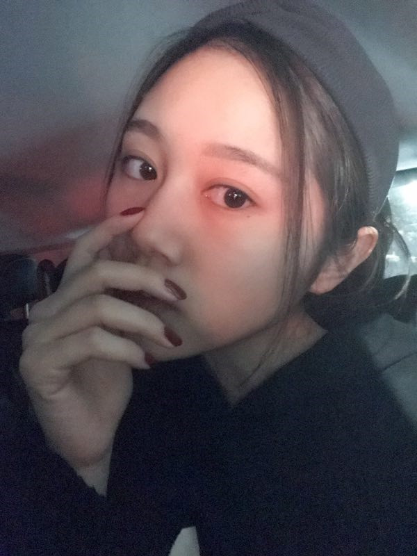 长春中妍医院眼部综合怎么样?价格案例
