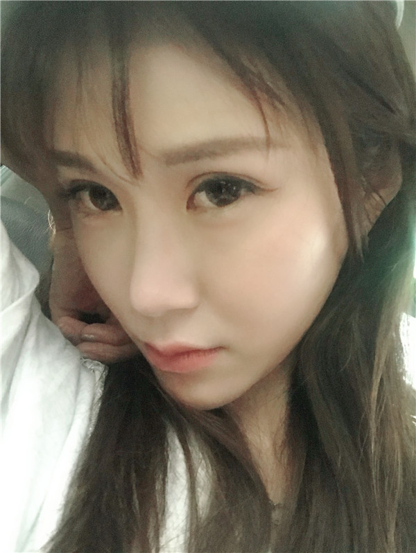 重庆艺星王方鹏双眼皮怎么样?价格案例