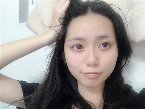 佛山市苏李秀英医院眼部整形怎么样?价格案例